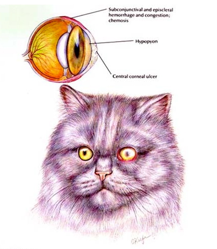 Corneal Ulcer